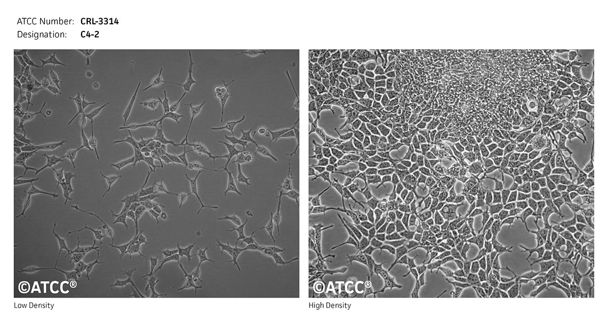 Cell Micrograph of C4-2, ATCC CRL-3314
