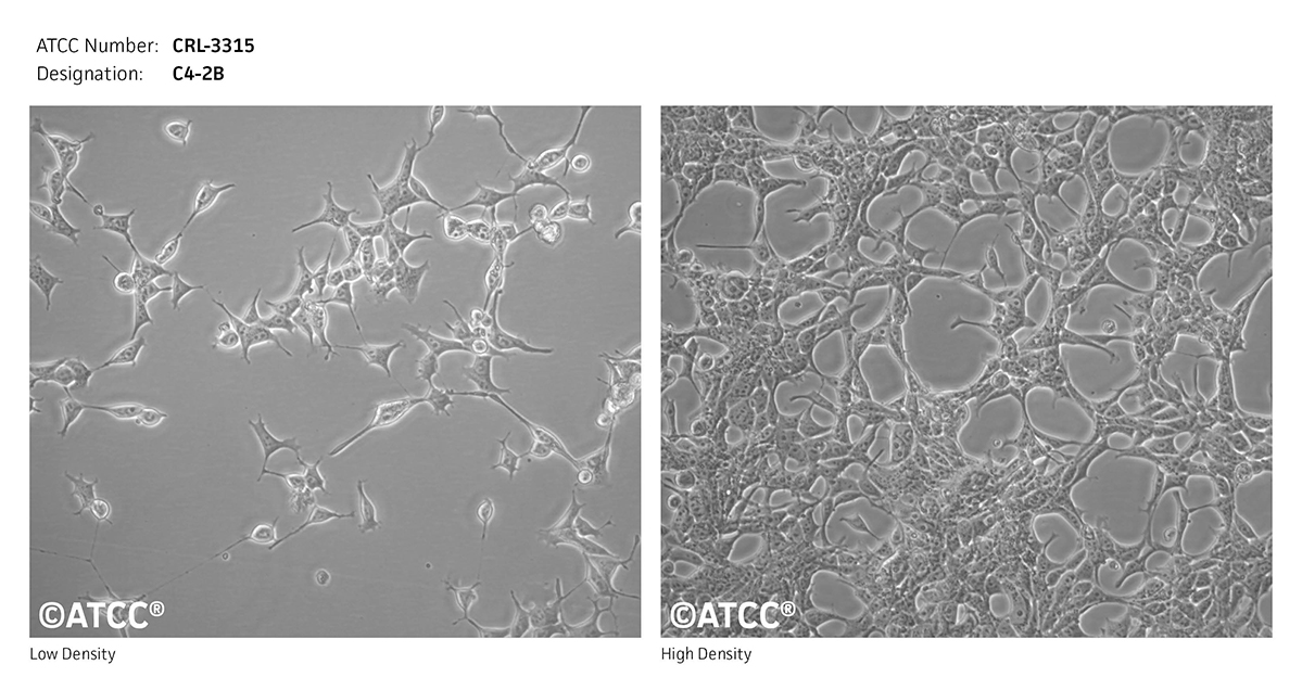 Micrograph of CRL-3315