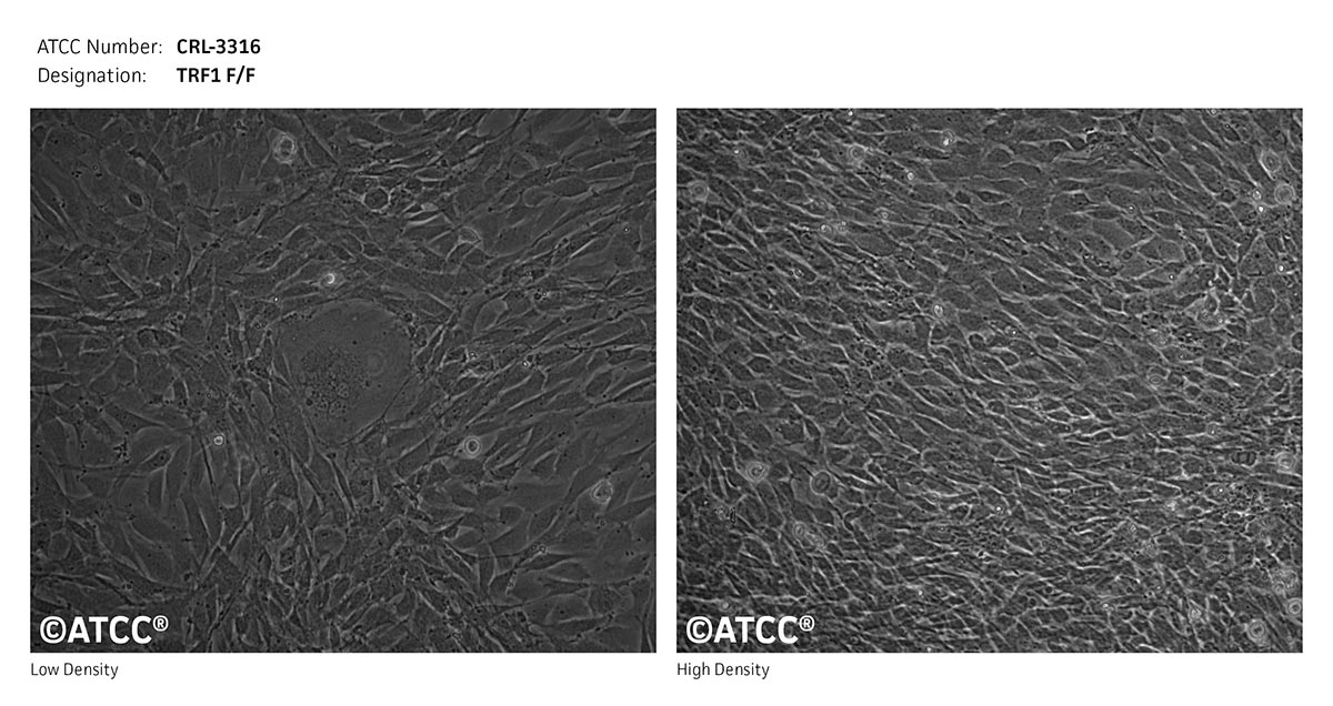 Cell Micrograph of TRF1 F/F cells, ATCC CRL-3316