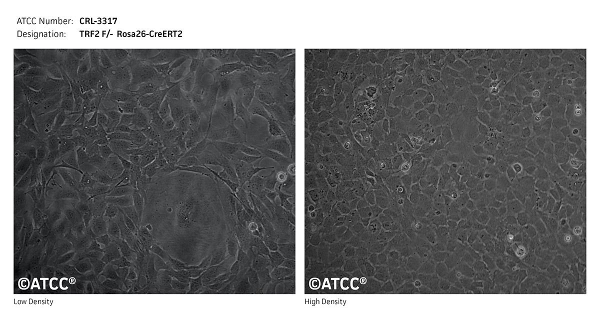 Cell Micrograph of TRF2 F/-Rosa 26-CreERT2 cells, ATCC CRL-3317
