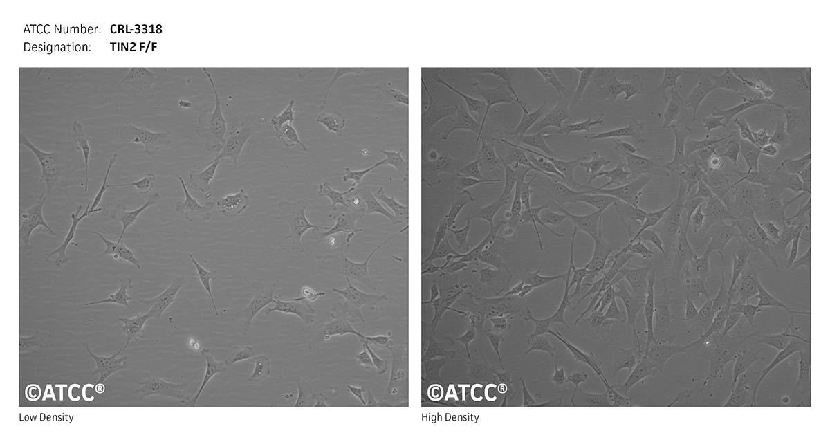 Cell Micrograph of TIN2 F/F cells, ATCC CRL-3318