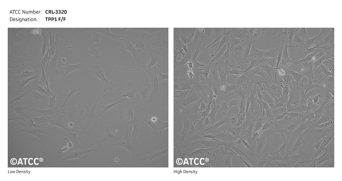 Cell Micrograph of TPP1 F/F(#35027-1), ATCC CRL-3320