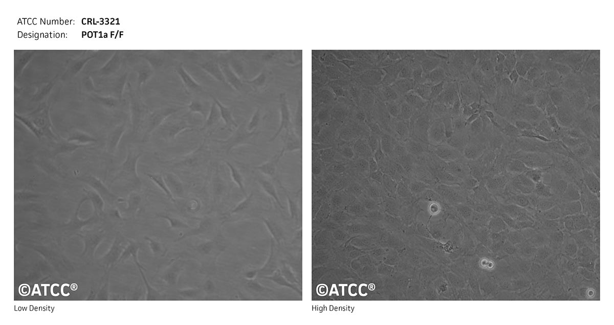 Cell Micrograph of POT1a F/F cells, ATCC CRL-3321