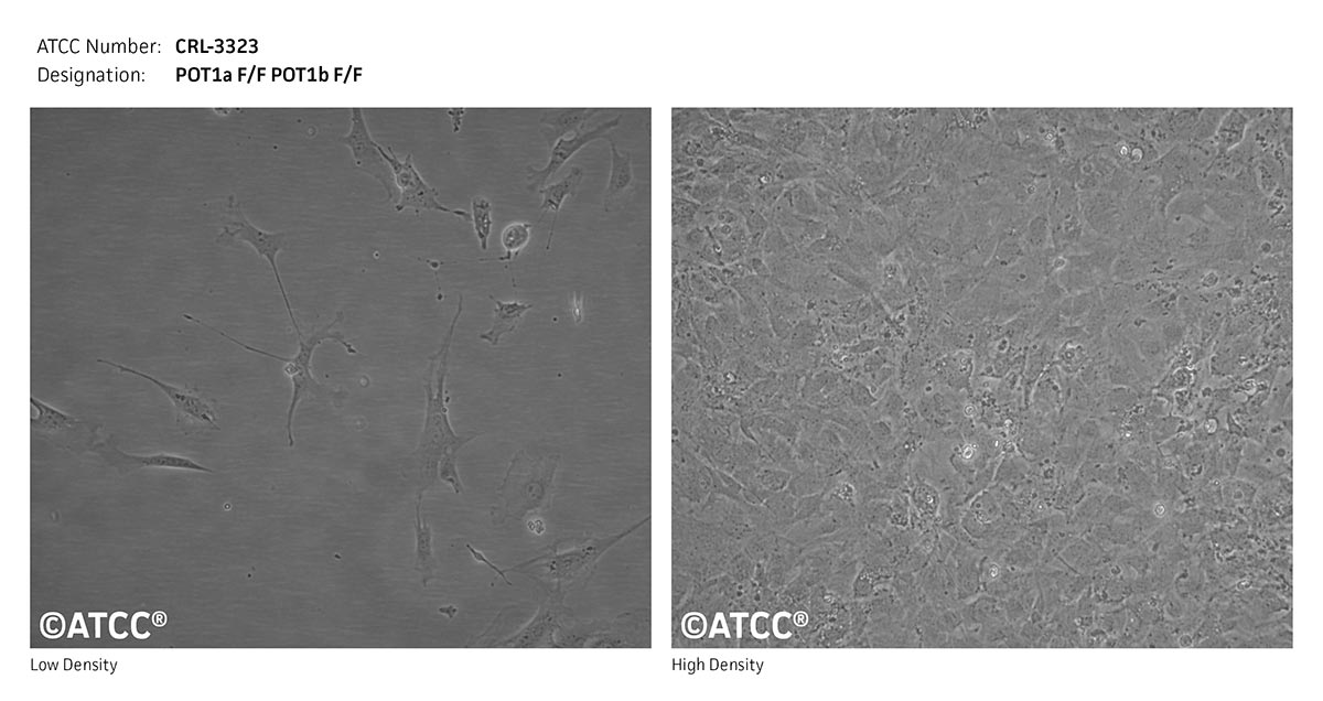 Cell Micrograph of POT1a F/F POT1b F/F(#20431-5), ATCC CRL-3323