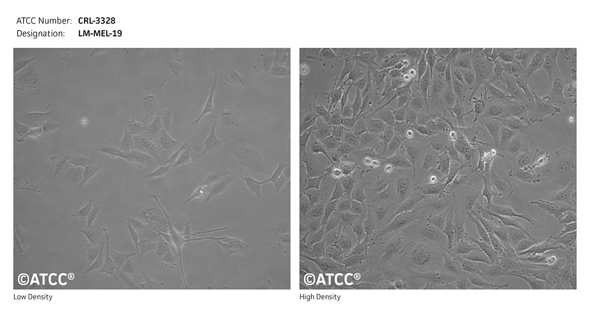 Cell Micrograph of ATCC CRL-3328 Cells