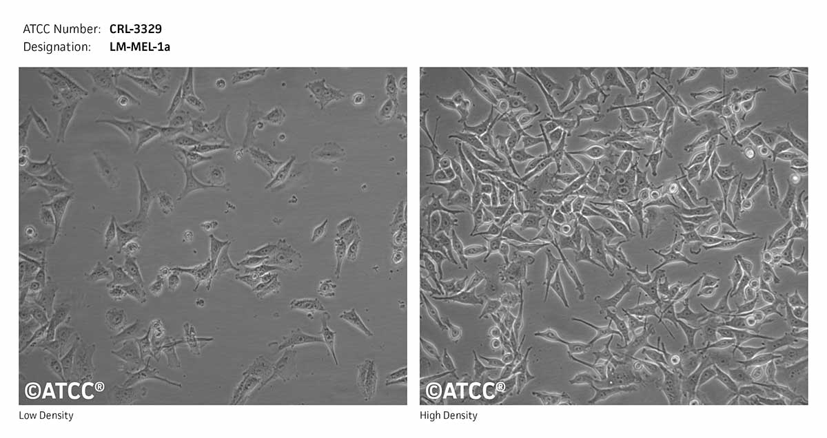 Cell Micrograph of ATCC CRL-3329