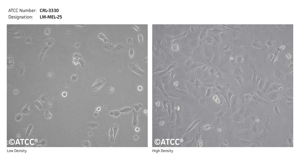Cell Micrograph of ATCC CRL-3330