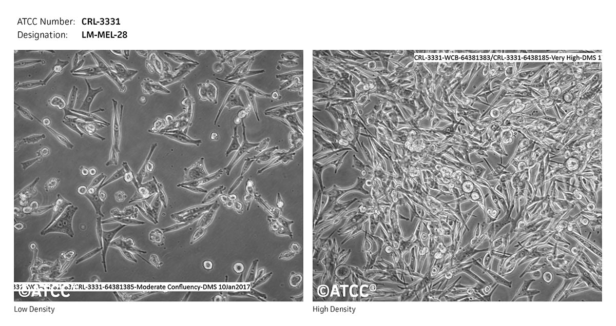 Cell Micrograph of LM-MEL-28 cells, ATCC CRL-3331