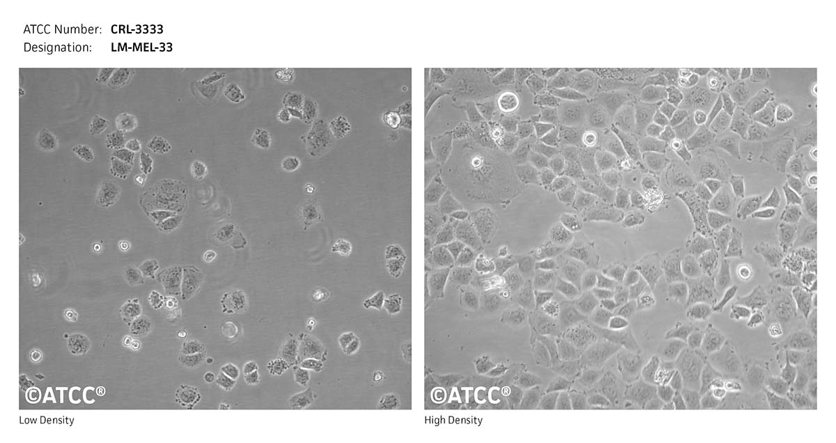 Cell Micrograph of ATCC CRL-3333