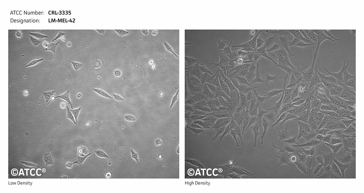 Cell Micrograph of ATCC CRL-3335