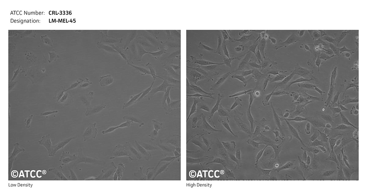 Cell Micrograph of ATCC CRL-3336