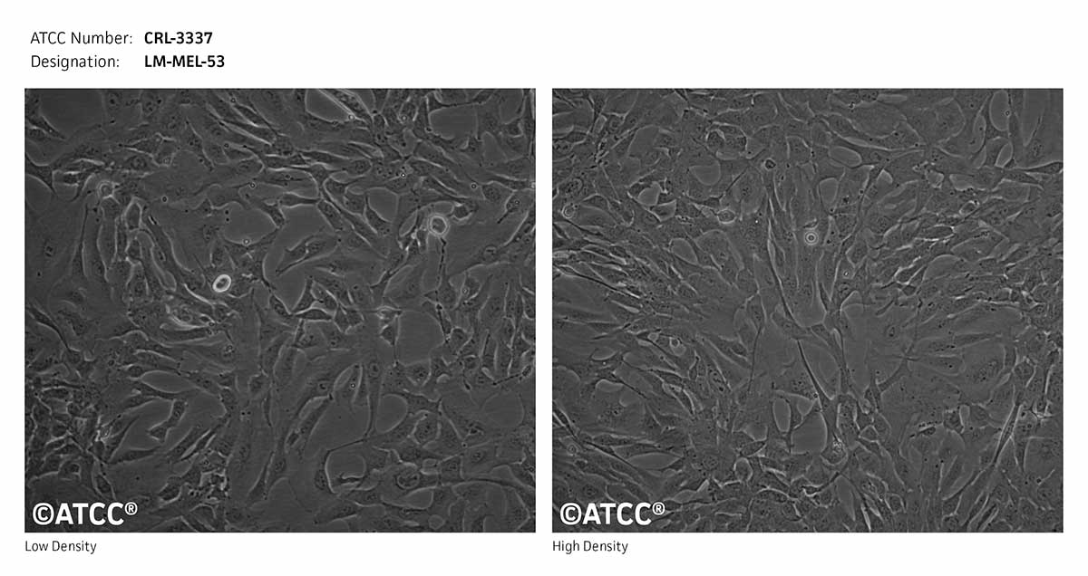 Cell Micrograph of LM-MEL-53 cells, ATCC CRL-3337