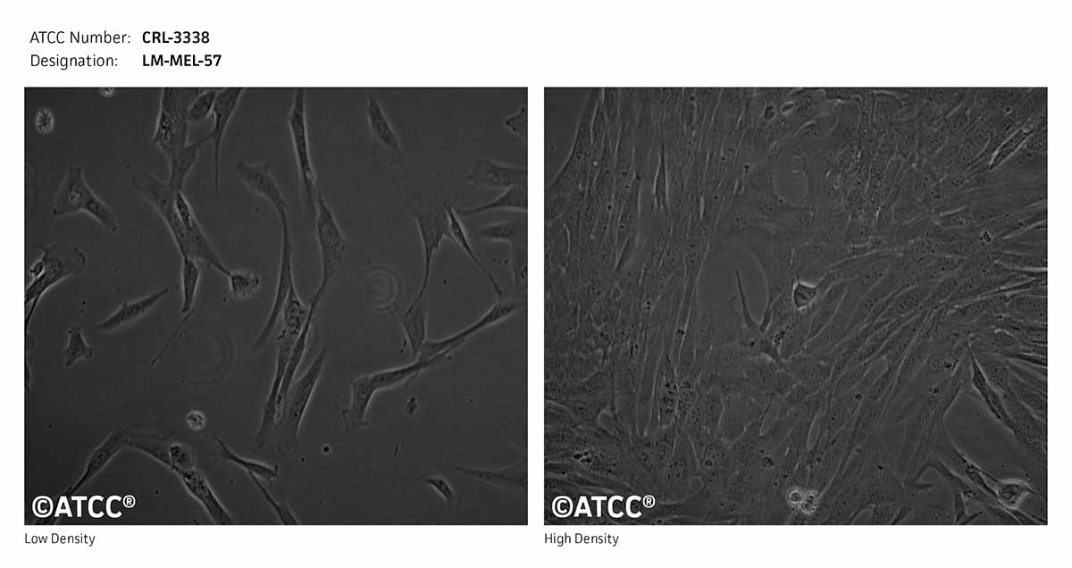Cell Micrograph of LM-MEL-57 cells, ATCC CRL-3338