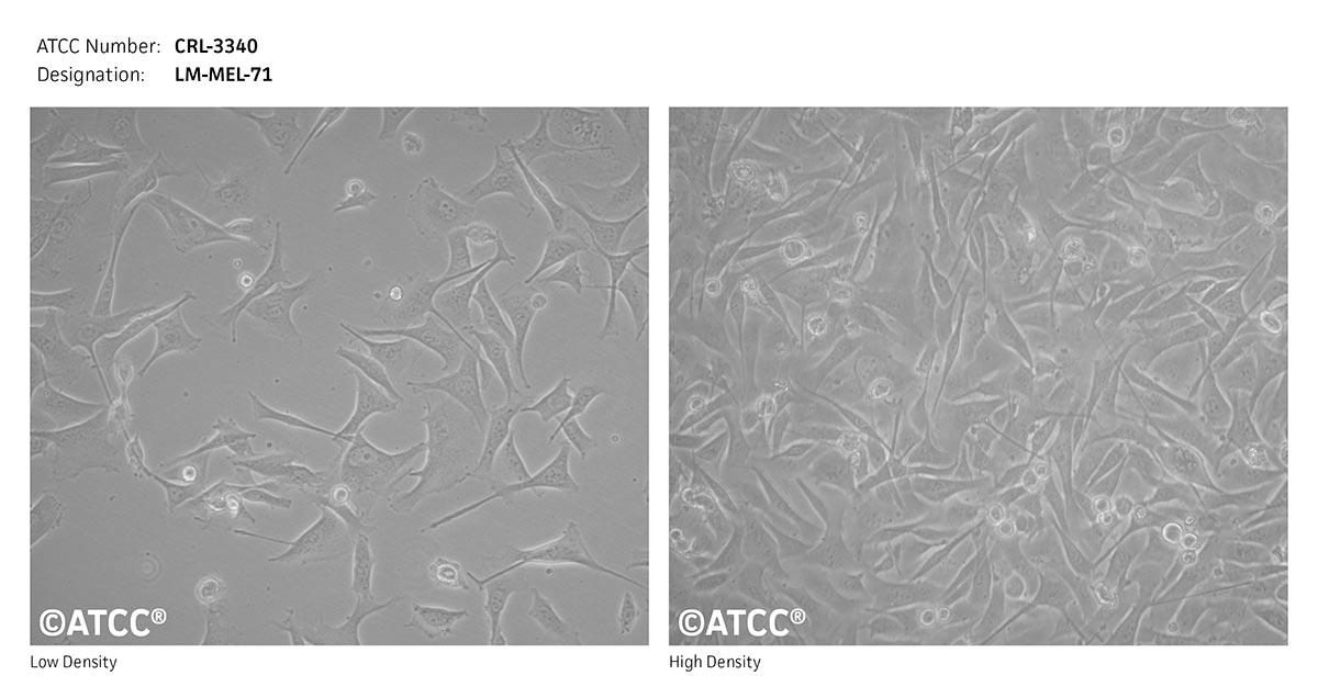 Cell Micrograph of LM-MEL-71, ATCC CRL-3340