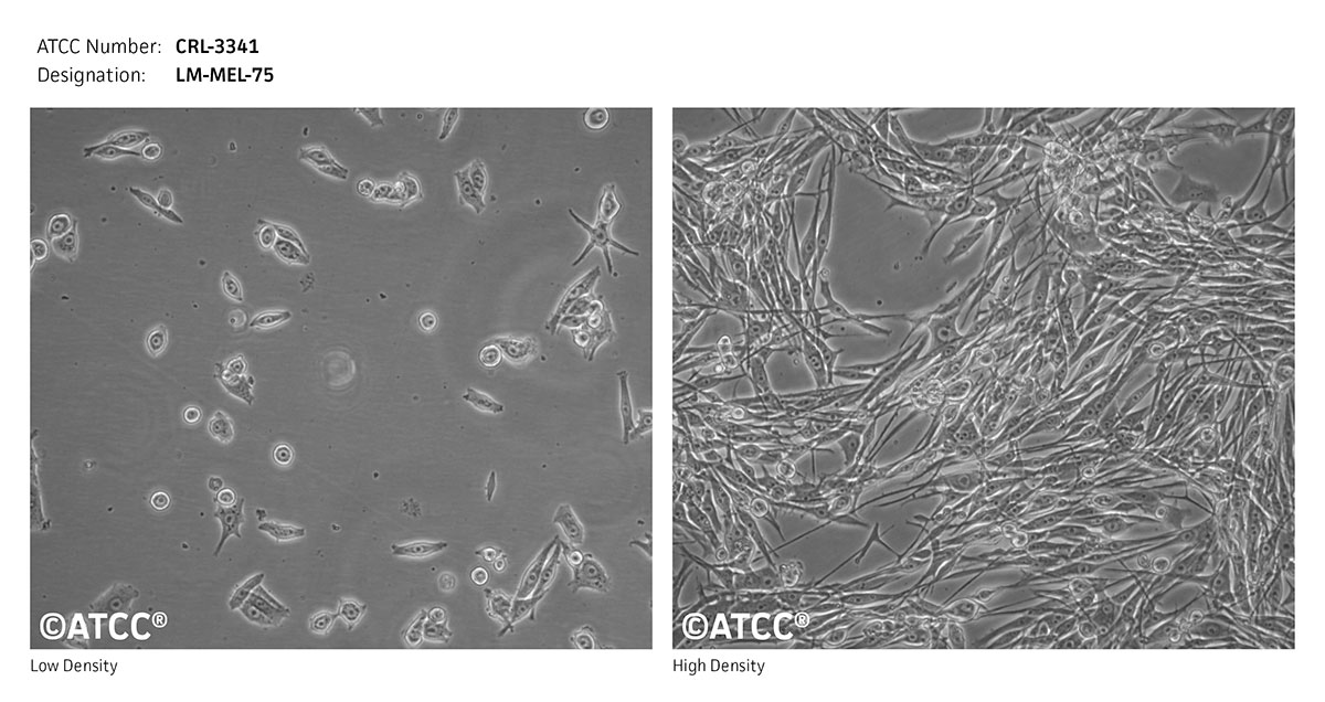 Cell Micrograph of LM-MEL-75 cells