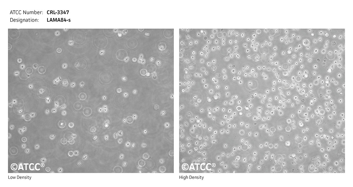 Cell Micrograph ATCC CRL-3347, LAMA84-s cells