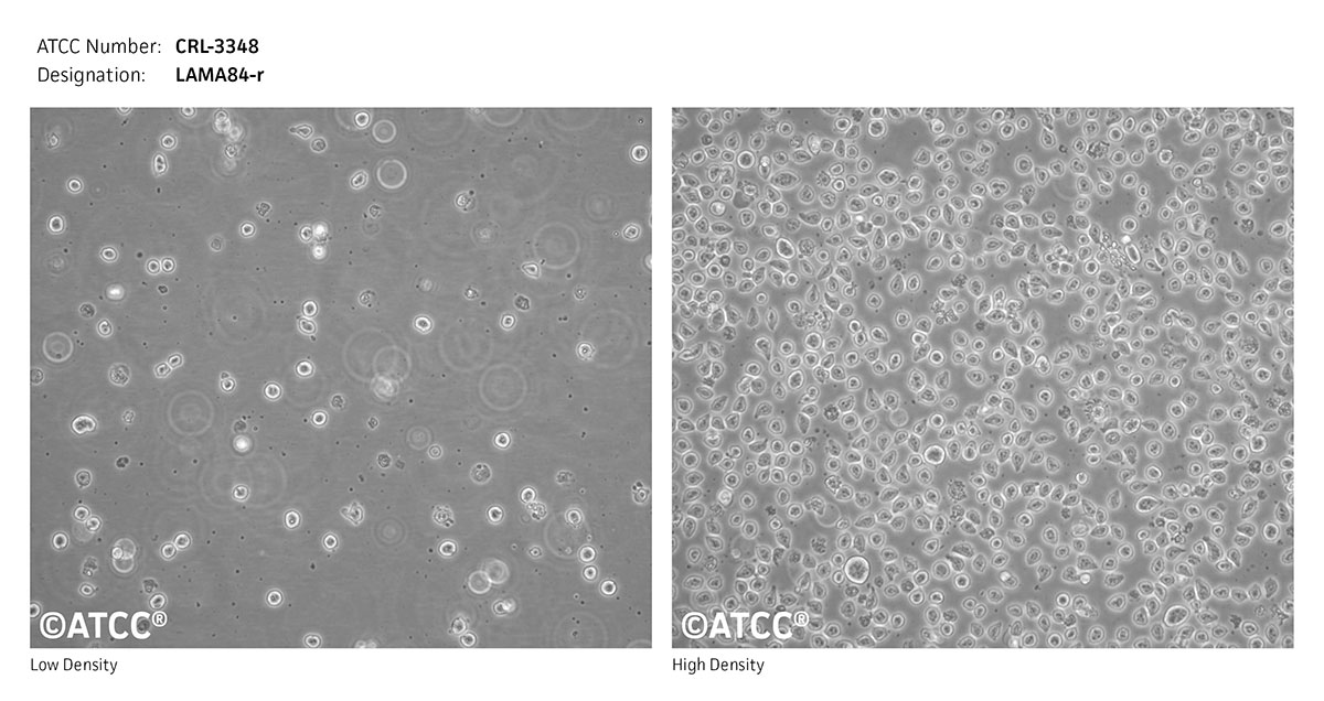 Cell Micrograph of ATCC CRL-3348, LAMA84-r cells
