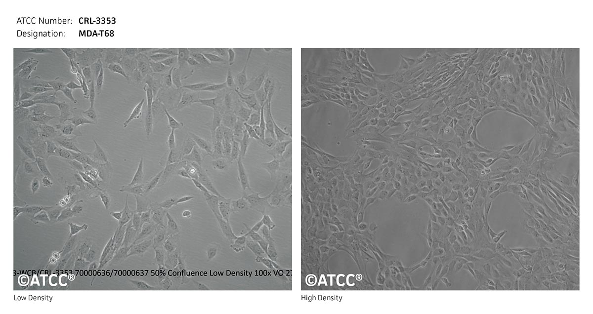 Cell Micrograph of MDA-T68 cells, ATCC CRL-3353