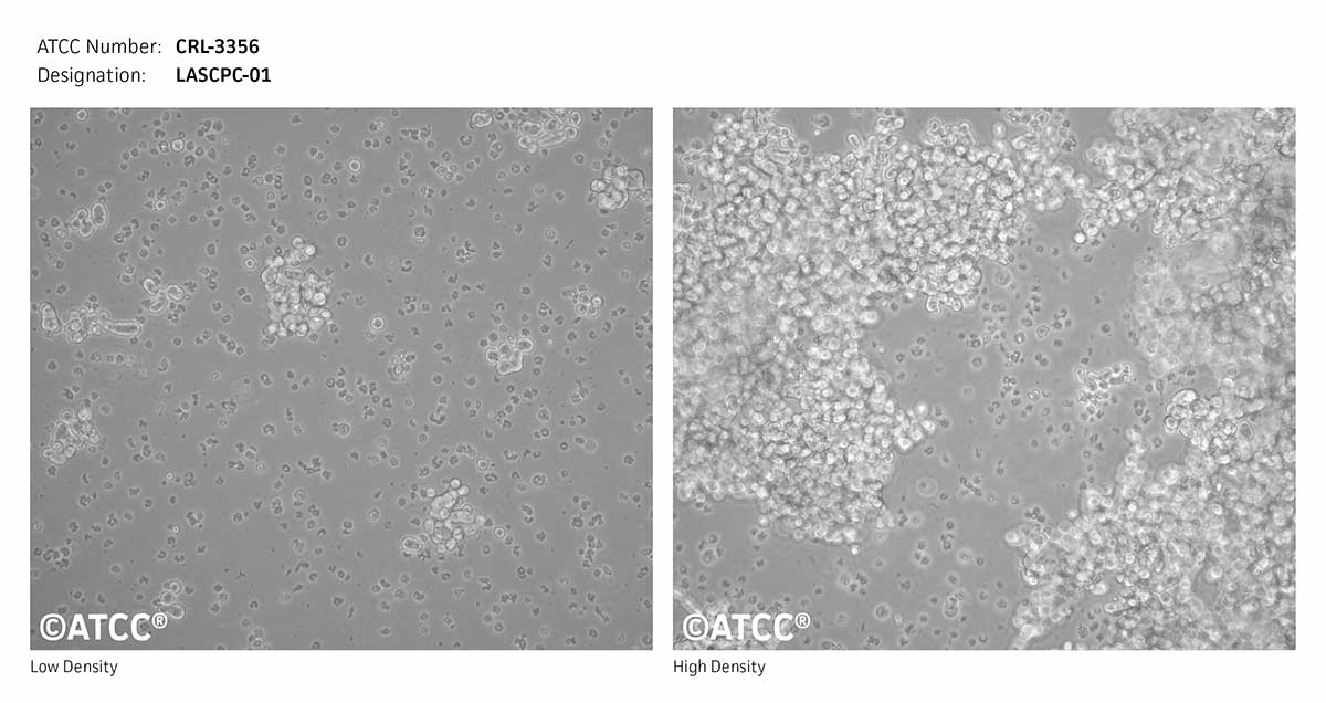Cell Micrograph of LASCPC-01 cells, ATCC CRL-3356