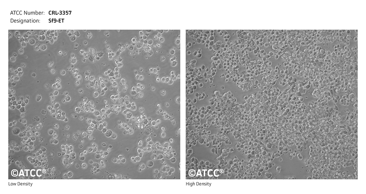 Micrograph of CRL-3357