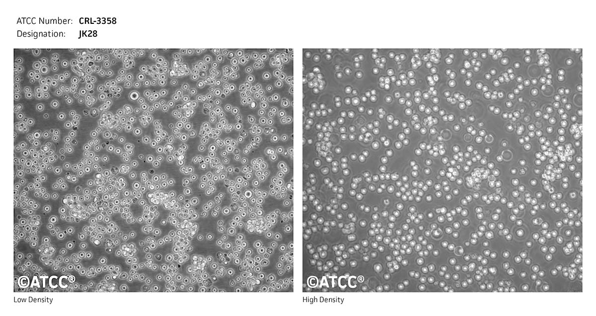 Cell Micrograph of JK28 cells, ATCC CRL-3358