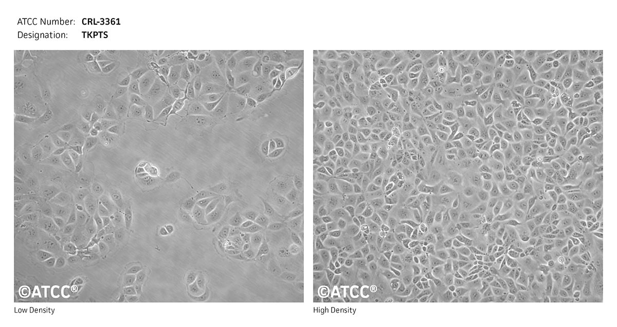 Cell Micrograph of TKPTS cells, ATCC CRL-3361