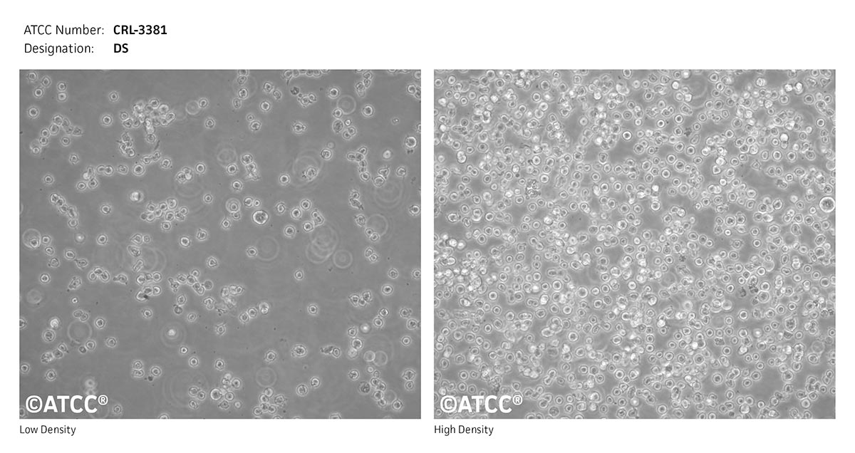 Cell Micrograph of DS cells, ATCC CRL-3381