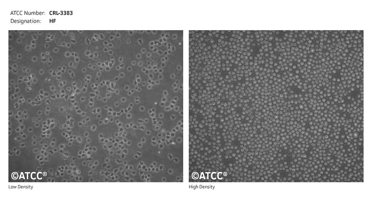 Cell Micrograph of ATCC CRL-3383 HF cell line