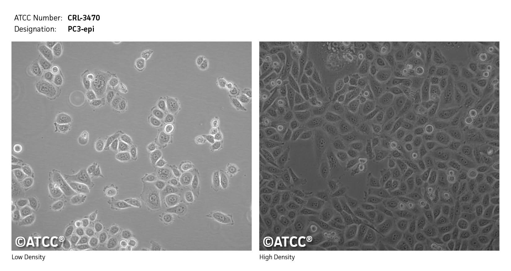 ATCC CRL-3470 Cell Micrograph
