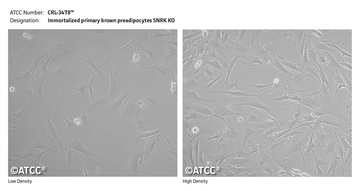 Cell micrograph CRL-3478