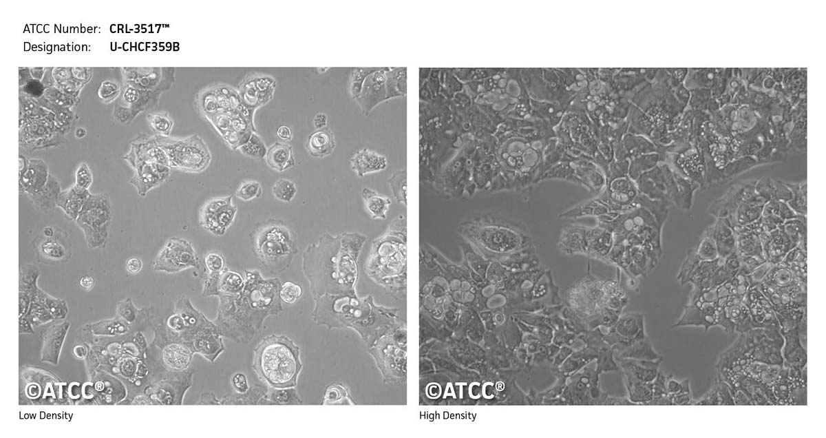 Micrograph of ATCC CRL-3517