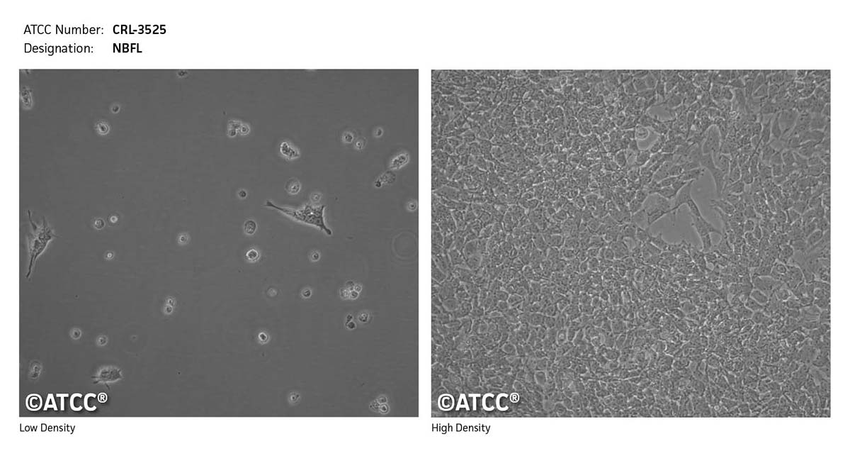 Cell micrograph of CRL-3525