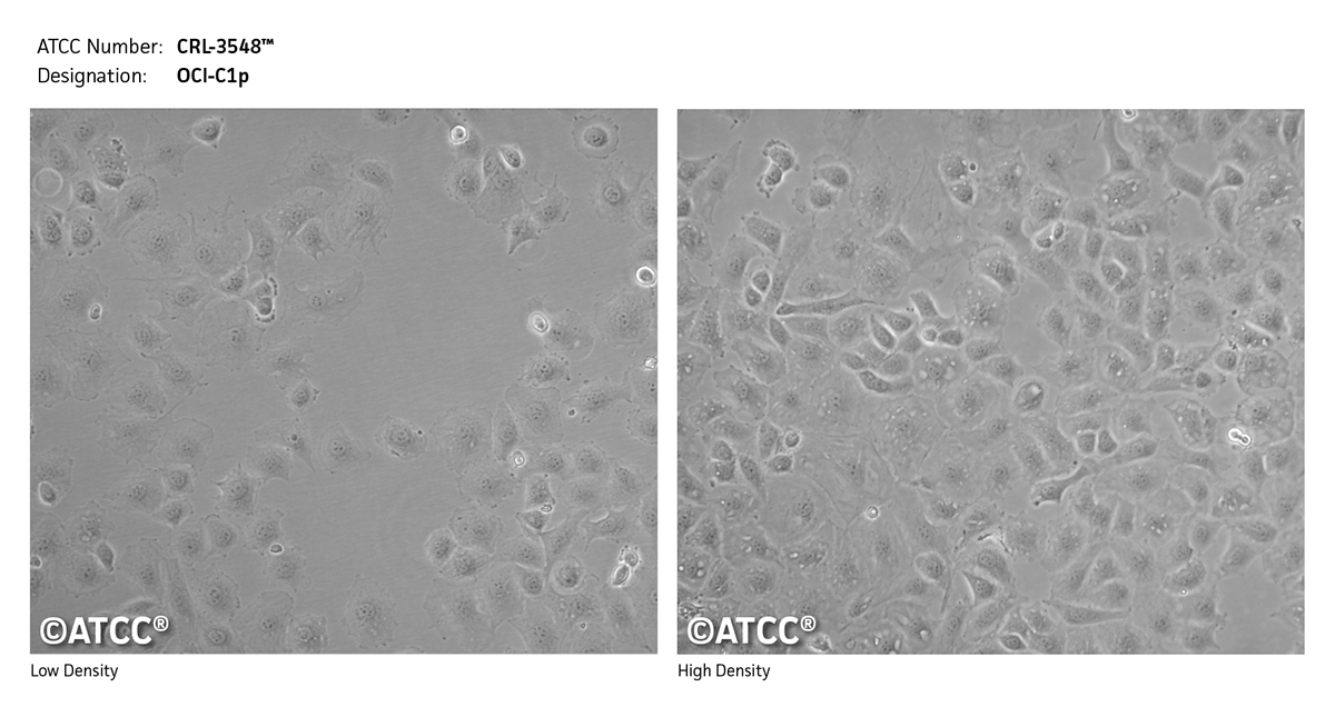 Cell micrograph of CRL-3548