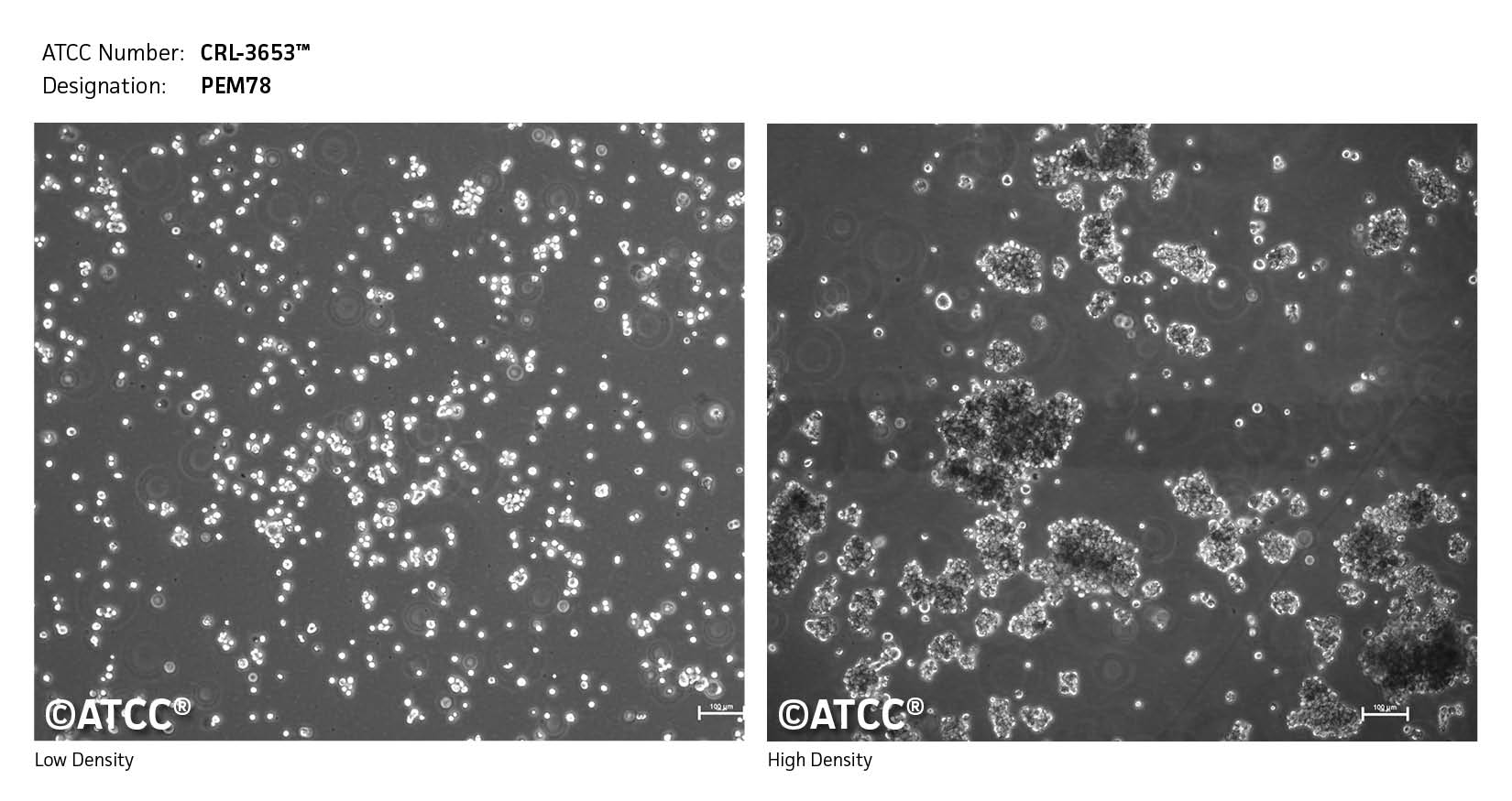 Micrograph of CRL-3653