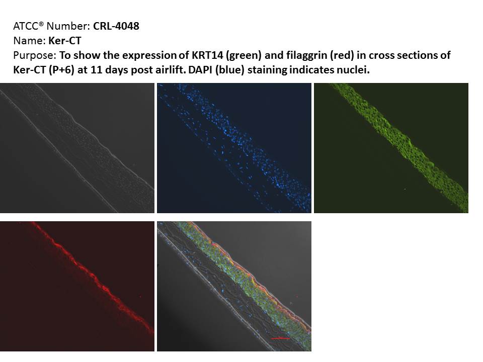 Ker-CT 11 Day Differentiation