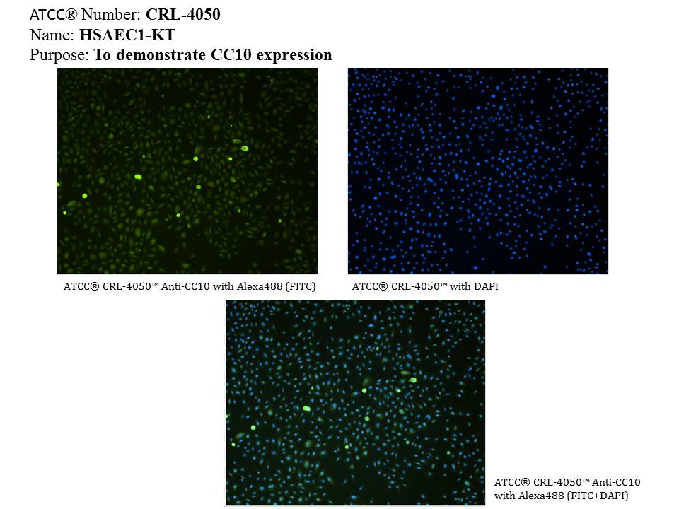 ATCC CRL-4050 CC10 Expression