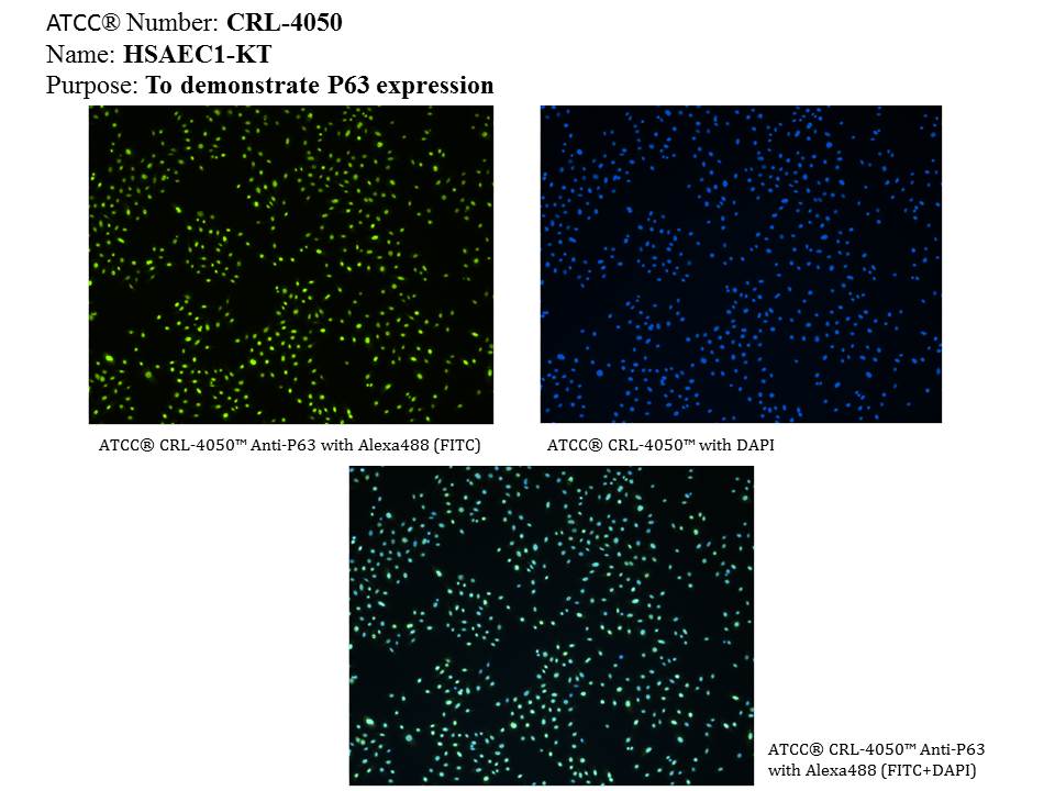 ATCC CRL-4050 P63 Expression Image