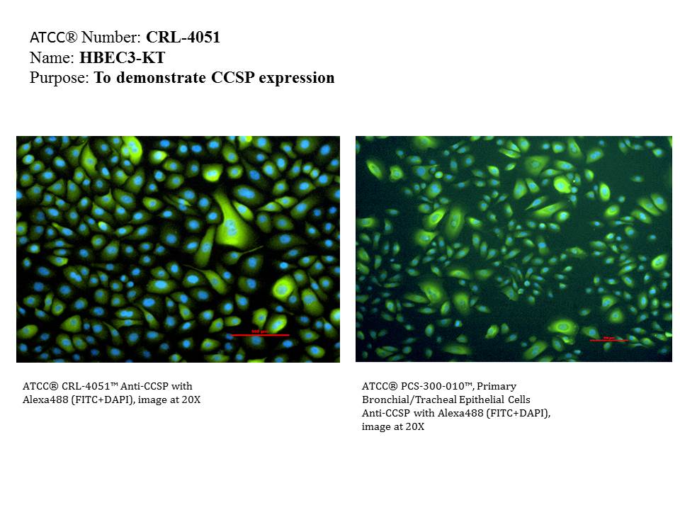 ATCC CRL-4051 CCSP Expression