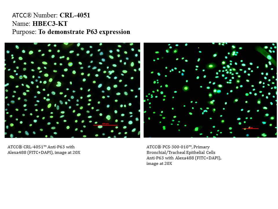 ATCC CRL-4051 P63 Expression Image