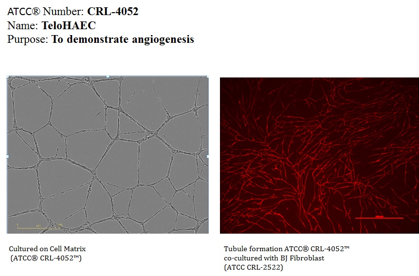 Angiogensis Co-Culture with BJ