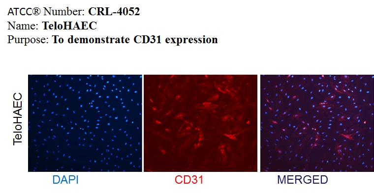 ATCC CRL-4052 CD31 Expression