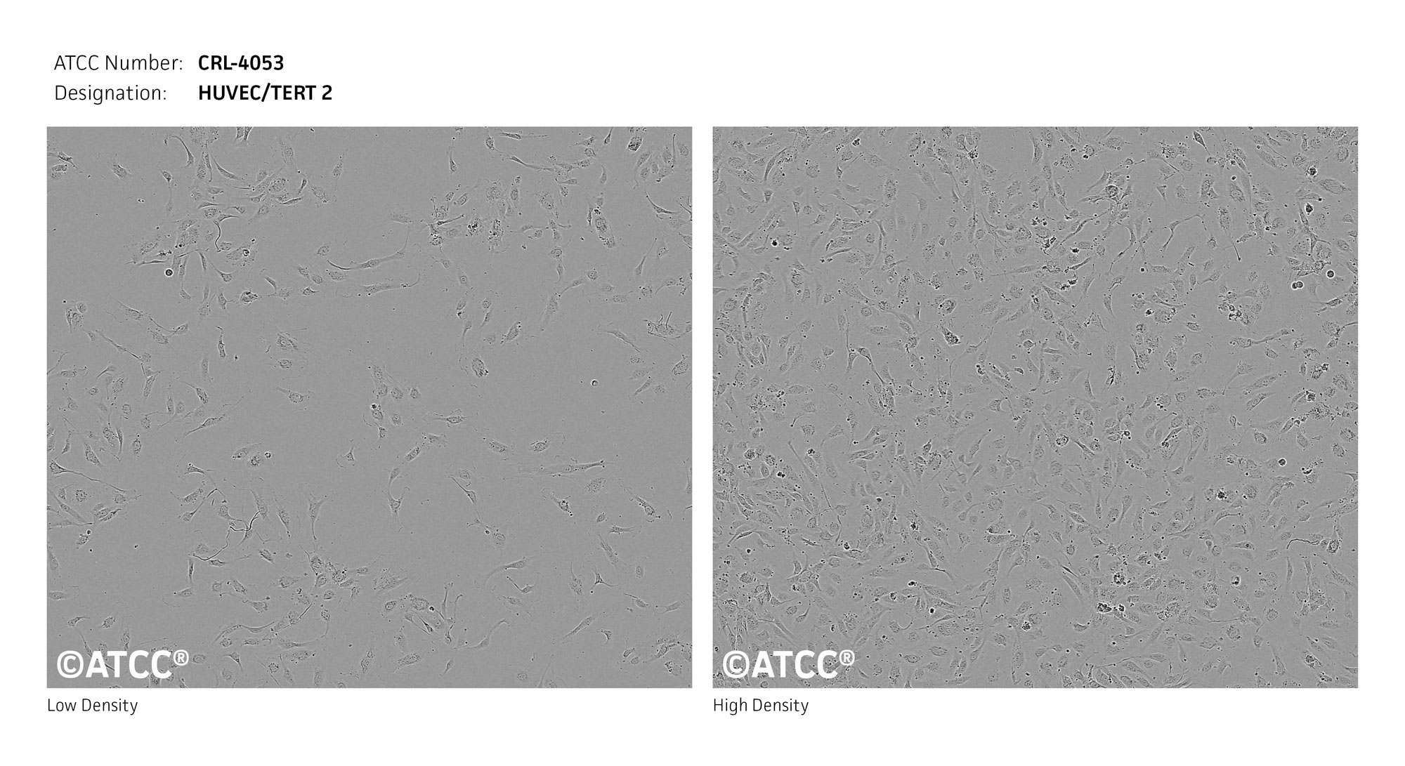 Cell Micrograph of HUVEC/TERT2 cells, CRL-4053