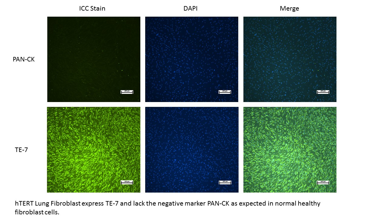 hTERT TE-7 Pan-CK staining