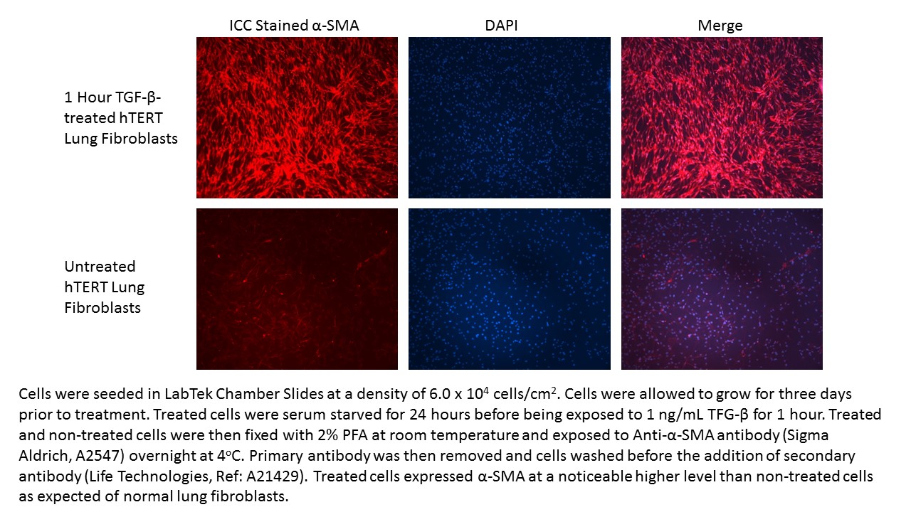 hTERT lung fibroblasts treated with TGF-Beta