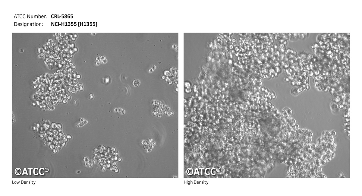 CRL-5865 Micrograph