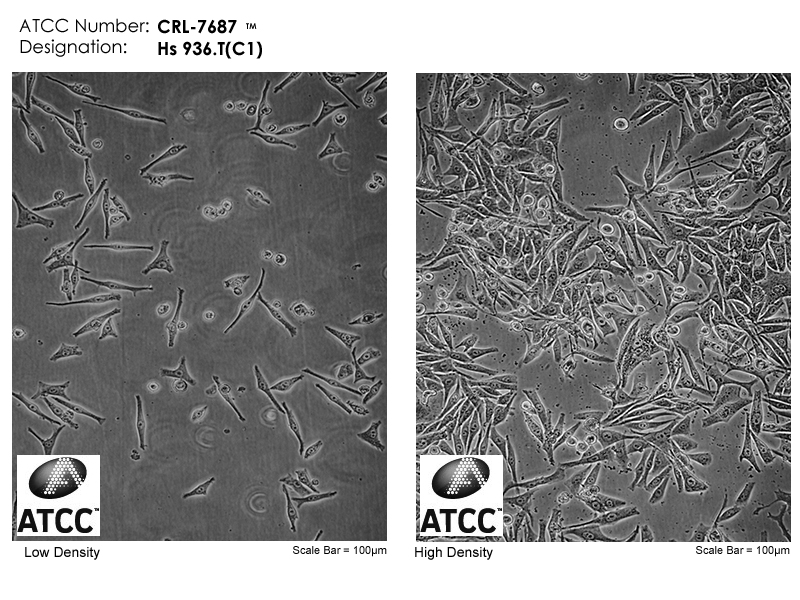 Hs 936.T(C1), ATCC CRL-7687 Cell Micrograph
