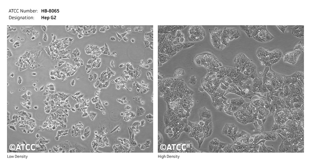 Cell Micrograph of ATCC HB-8065, Hep G2