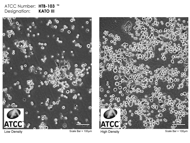 ATCC HTB-103 Cell Micrograph