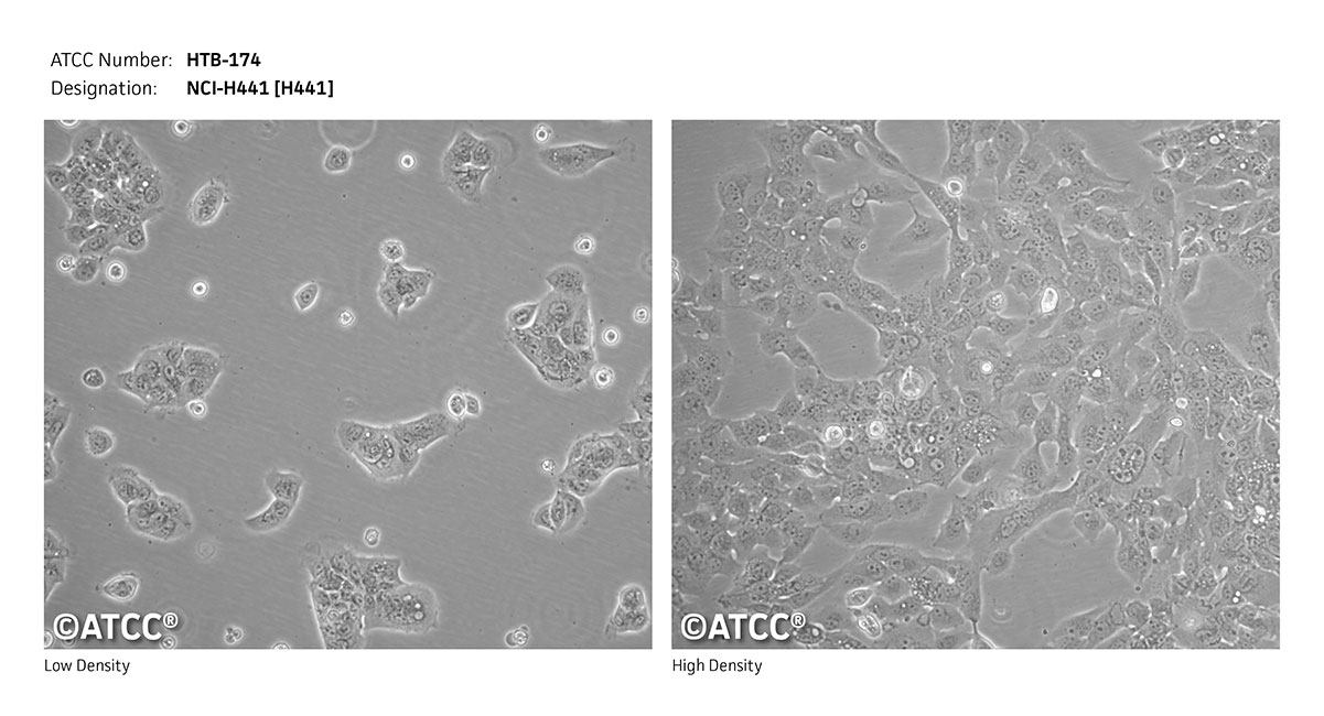 can endometrial biopsy detect cervical cancer