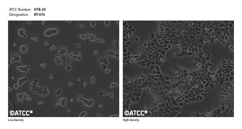 Cell Micrograph for ATCC HTB-20 BT-474